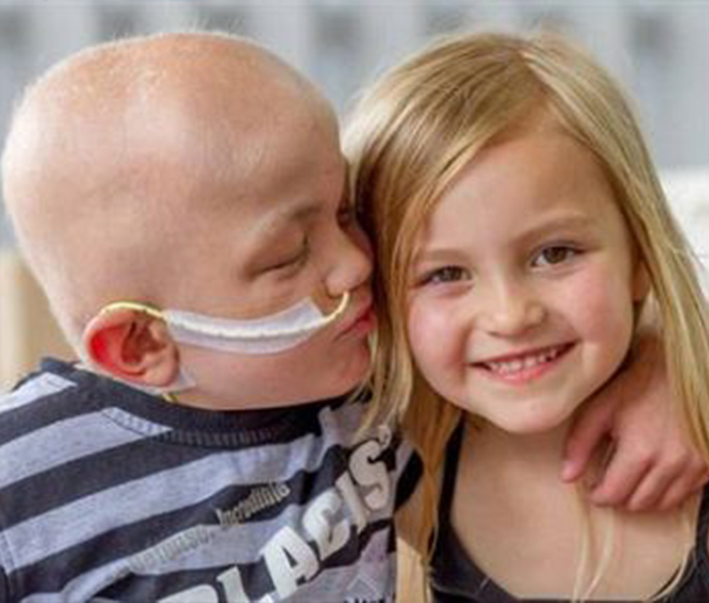 sick child kissing sibling on the cheek
